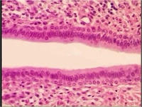 İdrarda Epitel Hücre Türleri ve Özellikleri